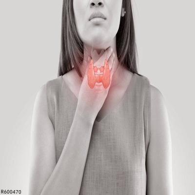 单纯性甲状腺肿注意事项有哪些