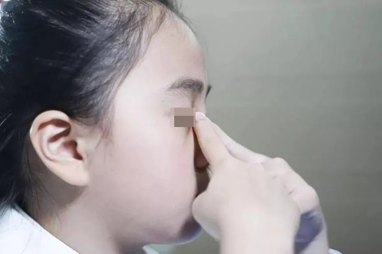 眼睛疲劳怎么按摩图解