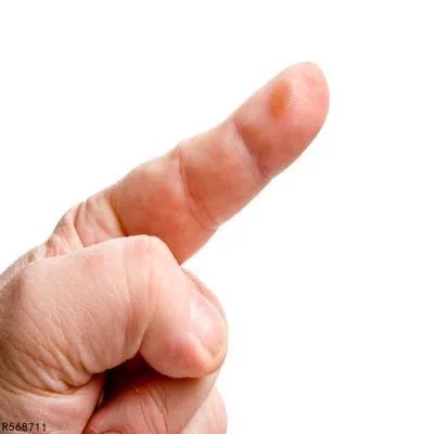 手指上长小水泡是什么原因导致的