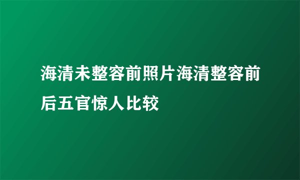 海清未整容前照片海清整容前后五官惊人比较