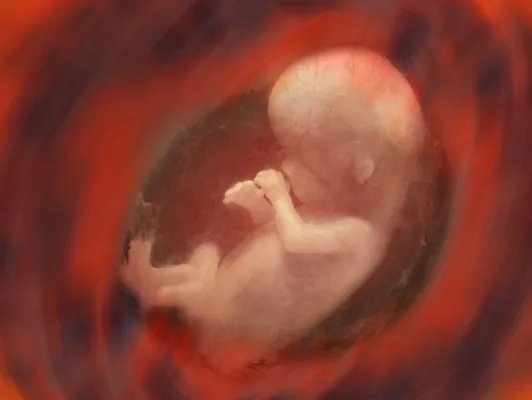 胎儿肾积水的治疗方法