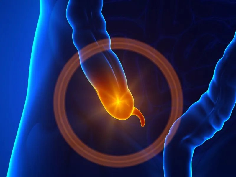 老年急性阑尾炎的诊断