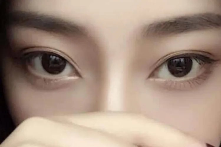 双眼皮分为哪几种类型图片